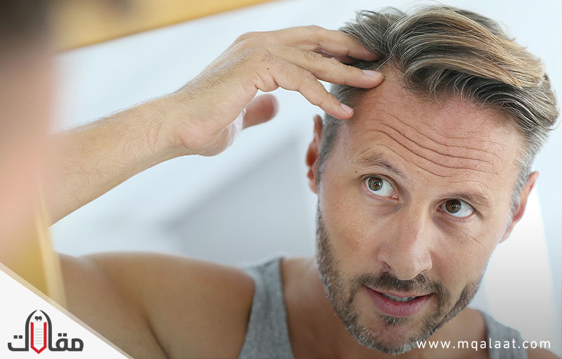 أهم أسباب تساقط الشعر بالتفصيل